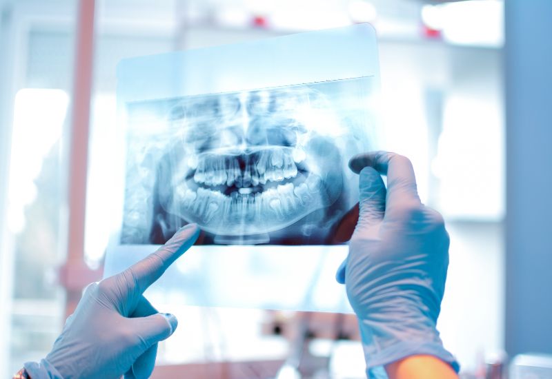 Advanced Digital X-Rays in McAllen