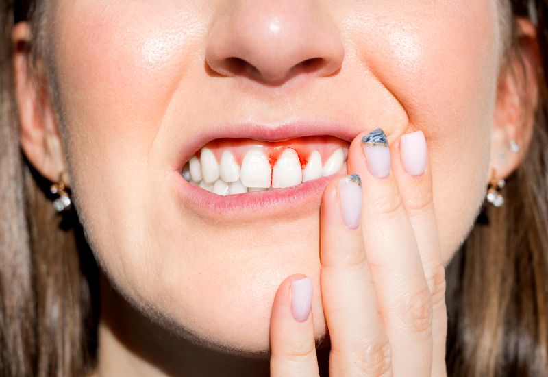 Gum Disease Treatments in McAllen