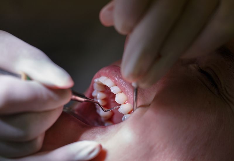 Gum Disease in McAllen, TX