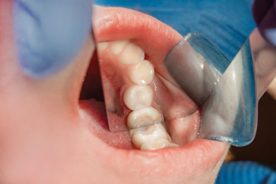 Restorative Dentistry in McAllen, TX